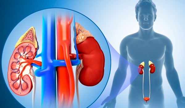 ckd