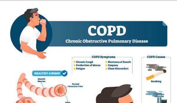 COPD